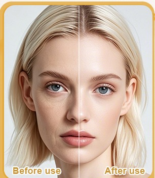 Third hydrated skin comparison